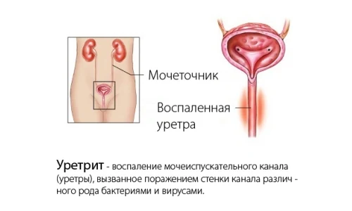 Картинка 4 Картинка 4
