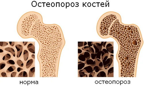 Картинка 4 Картинка 4