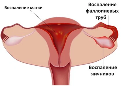 Картинка 2