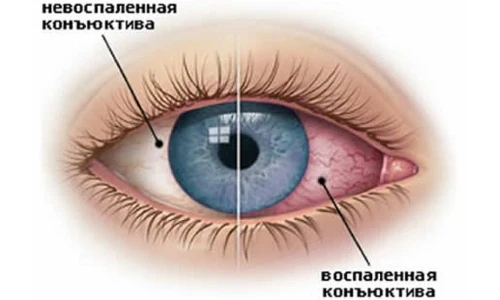 Иллюстрация 3 Иллюстрация 3