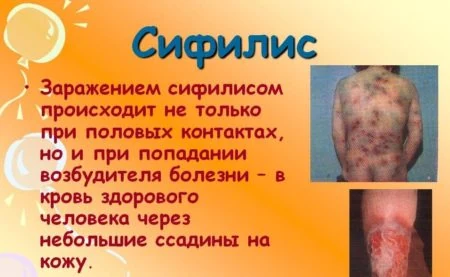 Изображение 2 Изображение 2