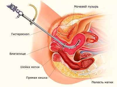 Иллюстрация 3
