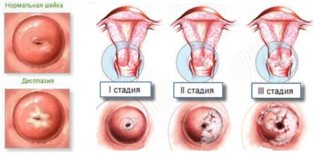 Иллюстрация 1 Иллюстрация 1