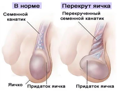 Картинка 3 Картинка 3