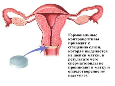 Картинка 3 Картинка 3