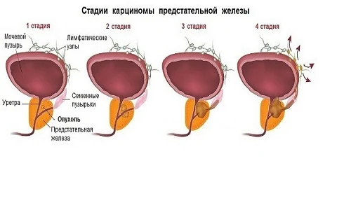 Изображение 3 Изображение 3
