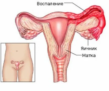 Иллюстрация 1 Иллюстрация 1