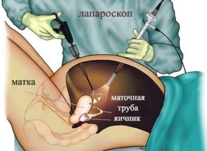 Иллюстрация 3