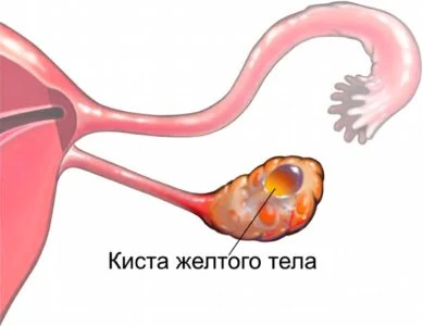Иллюстрация 9