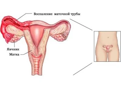 Иллюстрация 9 Иллюстрация 9