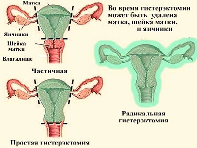 Картинка 2 Картинка 2