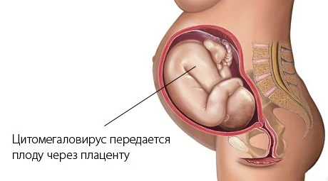 Картинка 2