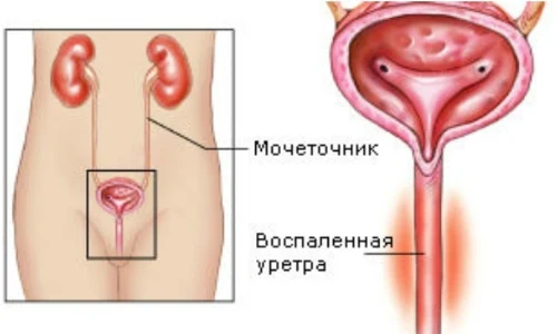 Изображение 3 Изображение 3