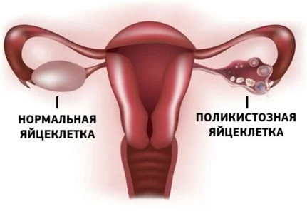 Изображение 4 Изображение 4