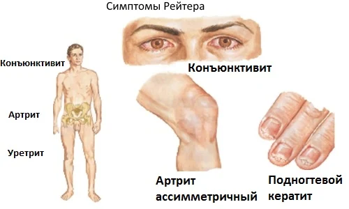 Иллюстрация 5 Иллюстрация 5