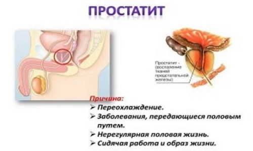 Иллюстрация 2 Иллюстрация 2