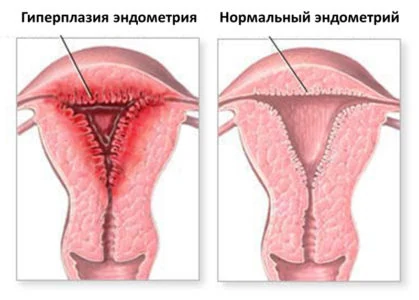 Изображение 5 Изображение 5