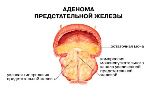 Иллюстрация 2