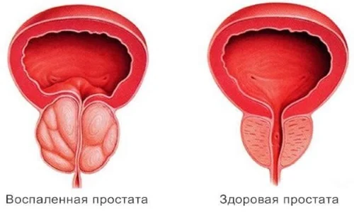 Иллюстрация 2 Иллюстрация 2