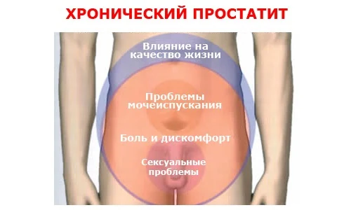 Иллюстрация 2