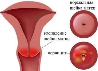 Изображение 6 Изображение 6