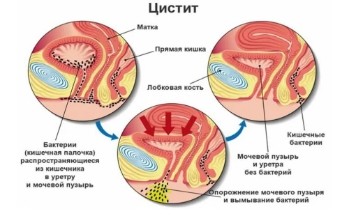 Изображение 4 Изображение 4