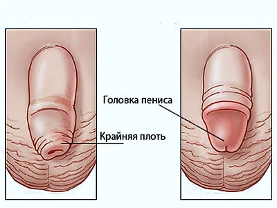 Иллюстрация 1 Иллюстрация 1