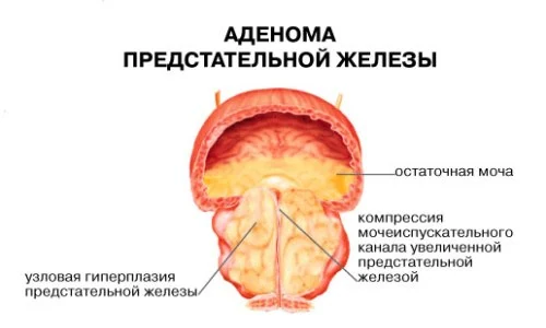Картинка 4 Картинка 4