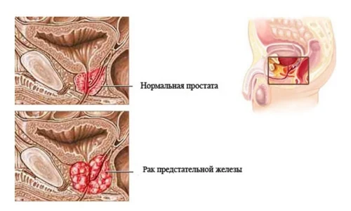 Изображение 2 Изображение 2