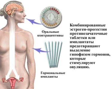 Картинка 3 Картинка 3