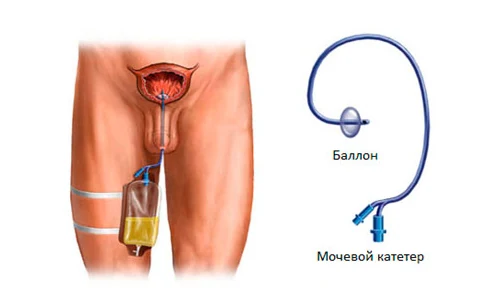 Иллюстрация 3