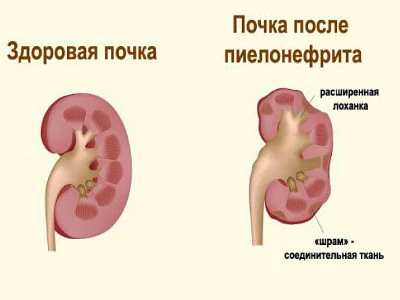 Изображение 2 Изображение 2