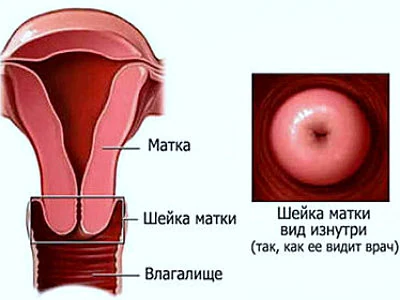 Изображение 1 Изображение 1