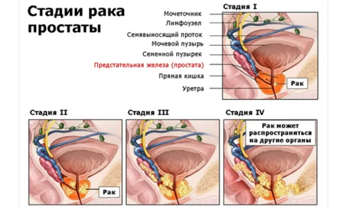 Иллюстрация 4 Иллюстрация 4