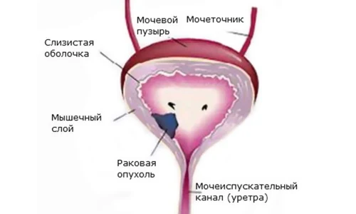 Картинка 4 Картинка 4