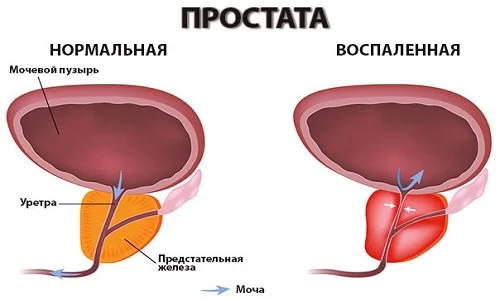 Изображение 3 Изображение 3