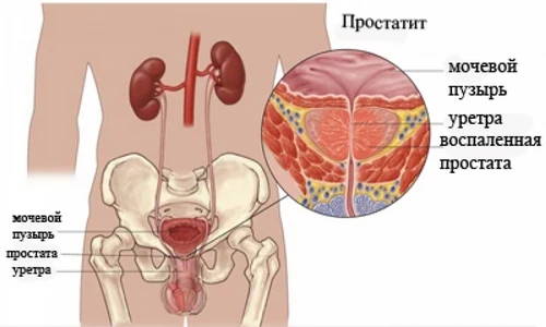 Картинка 2 Картинка 2
