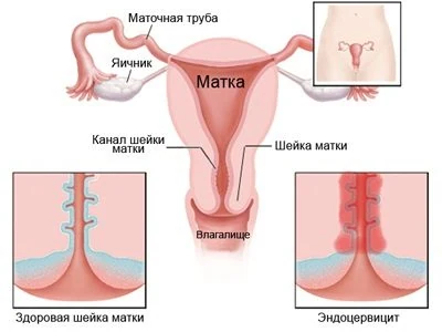 Изображение 1 Изображение 1