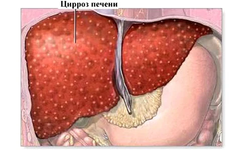 Картинка 4 Картинка 4