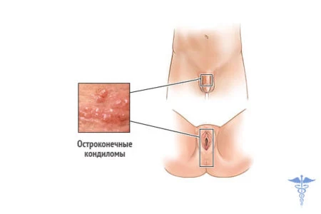 Картинка 3 Картинка 3