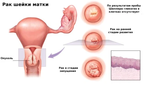 Картинка 2 Картинка 2
