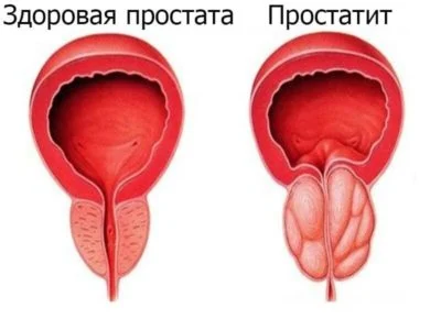 Иллюстрация 2 Иллюстрация 2