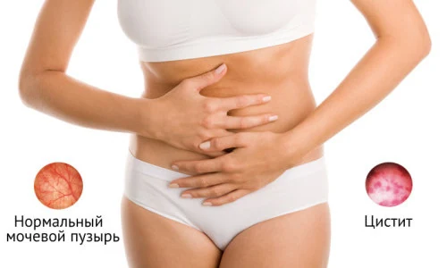 Картинка 1 Картинка 1