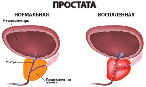 Иллюстрация 2 Иллюстрация 2