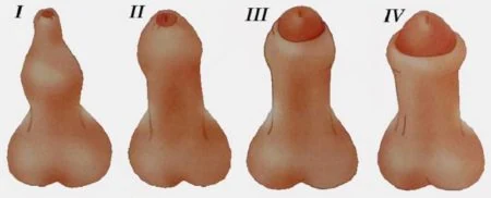 Изображение 2 Изображение 2