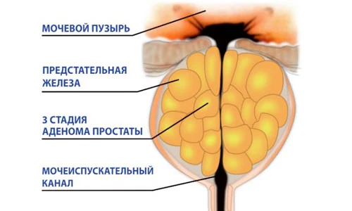 Иллюстрация 2