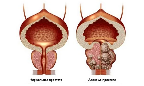 Изображение 2 Изображение 2