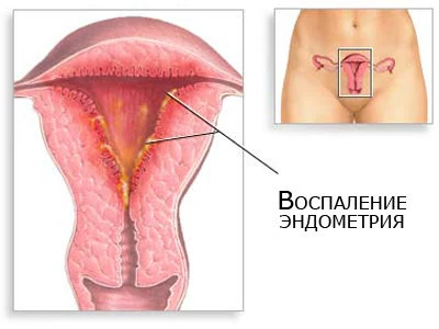 Картинка 3 Картинка 3