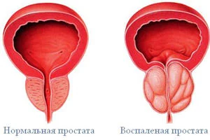 Картинка 2 Картинка 2