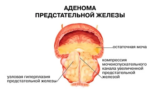 Картинка 3 Картинка 3